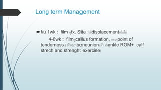 Long term Management
f/u 1wk : film ดูfx. Site ว่ามีdisplacementหรือไม่
4-6wk : filmดูcallus formation, ตรวจpoint of
tenderness ( ถ้าพบว่าboneunionแล้ว ทาankle ROM+ calf
strech and strenght exercise)
 