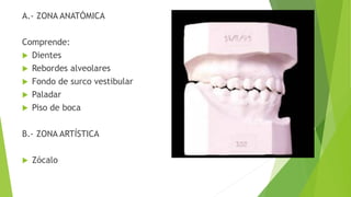 A.- ZONA ANATÓMICA
Comprende:
 Dientes
 Rebordes alveolares
 Fondo de surco vestibular
 Paladar
 Piso de boca
B.- ZONA ARTÍSTICA
 Zócalo
 