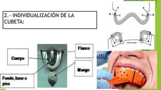 2.- INDIVIDUALIZACIÓN DE LA
CUBETA:
 