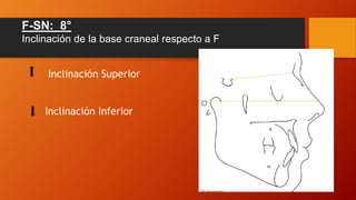 F-SN: 8°
Inclinación de la base craneal respecto a F
Inclinación Superior
Inclinación Inferior
 