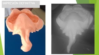 IMPRESIÓN DEFINITIVA
 