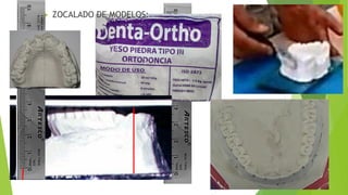  ZOCALADO DE MODELOS:
 