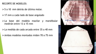 RECORTE DE MODELOS:
5 a 10 mm detrás de última molar.
17 mm a cada lado de base angulado
La base del modelo maxilar y mandibular
medirán entre 13 a 15 mm
La medida de cada arcada entre 35 a 40 mm
Ambos modelos montados miden 70 a 75 mm
 