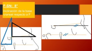 F-SN: 8°
Inclinación de la base
craneal respecto a F
 