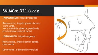 SN-MGo: 32° (+-5°):
-AUMENTADO: Hiperdivergente
Rama corta, ángulo gonial obtuso,
cara larga,
rel a mordida abierta, patrón de
crecimiento vertical facial
-DISMINUIDO: Hipodivergente
Rama larga, ángulo gonial agudo,
cara corta.
Determina la dimensión vertical
 