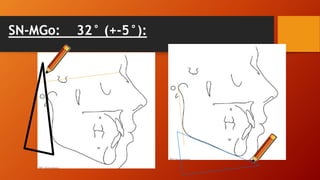 SN-MGo: 32° (+-5°):
 