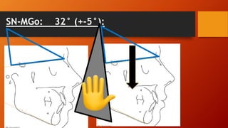 SN-MGo: 32° (+-5°):
 