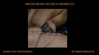 ARCOS MEAW-TECNICA INDIRECTA
CD. Sandro Mayaute Q.Asesora: Dra. Paola Caballero
 