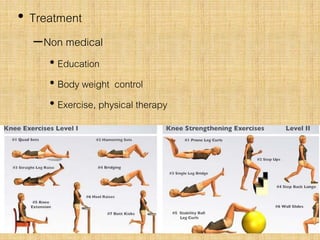 • Treatment
–Non medical
• Education
• Body weight control
• Exercise, physical therapy
 