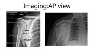 Imaging:AP view
 