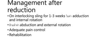 Management after
reduction
• On interlocking sling for 1-3 weeks ในท่า adduction
and internal rotation
• ห้ามทาท่า abduction and external rotation
• Adequate pain control
• Rehabilitation
 