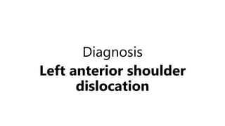 Diagnosis
Left anterior shoulder
dislocation
 