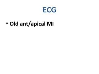 • Old ant/apical MI
ECG
 