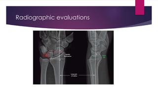 Radiographic evaluations
 
