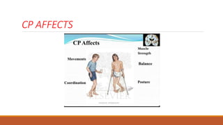 CP AFFECTS
 