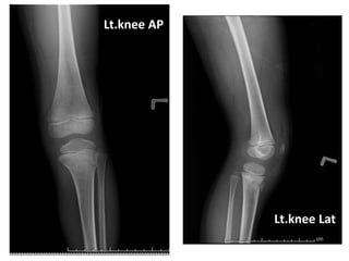 Lt.knee AP
Lt.knee Lat
 