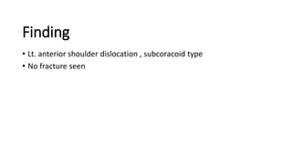 Finding
• Lt. anterior shoulder dislocation , subcoracoid type
• No fracture seen
 