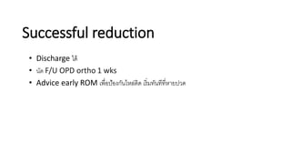Successful reduction
• Discharge ได้
• นัด F/U OPD ortho 1 wks
• Advice early ROM เพื่อป้องกันไหล่ติด เริ่มทันทีที่หายปวด
 