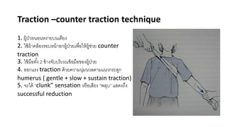 1. ผู้ป่วยนอนหงายบนเตียง
2. ใช้ผ้าคล้องรอบหน้าอกผู้ป่วยเพื่อให้ผู้ช่วย counter
traction
3. ใช้มือทั้ง 2 ข้างจับบริเวณข้อมือของผู้ป่วย
4. ออกแรง traction ด้วยความนุ่มนวลตามแนวกระดูก
humerus ( gentle + slow + sustain traction)
5. จะได้ “clunk” sensation หรือเสียง “พลุบ” แสดงถึง
successful reduction
Traction –counter traction technique
 