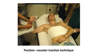 Traction –counter traction technique
 