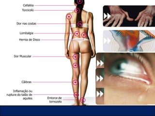 Síndromes mais frequentes<br />Lombalgia (coluna lombar)<br />Tendinites / tendinoses (ombro, cotovelo, joelho, tornozelo)...