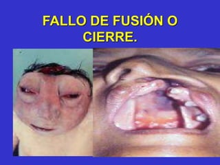 FALLO DE FUSIÓN O
CIERRE.
 