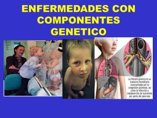 ENFERMEDADES CON
COMPONENTES
GENETICO
 