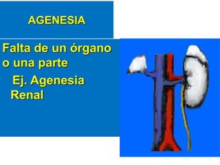 AGENESIA
Falta de un órgano
o una parte
Ej. Agenesia
Renal
 