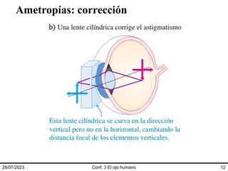 Ametropías: corrección
28/07/2023 Conf. 3 El ojo humano 12
 