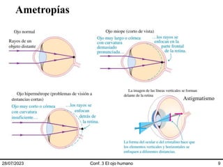Ametropías
28/07/2023 Conf. 3 El ojo humano 9
Astigmatismo
 