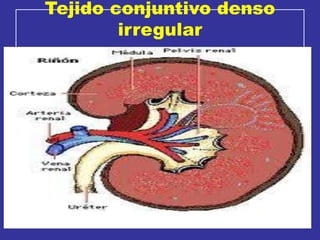 Tejido conjuntivo denso
irregular
 