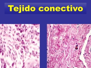 Tejido conectivo
 