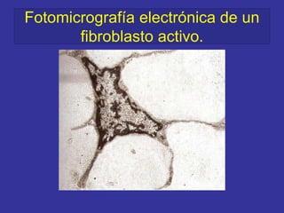 Fotomicrografía electrónica de un
fibroblasto activo.
 