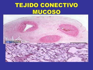 TEJIDO CONECTIVO
MUCOSO
 