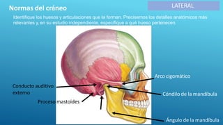 LATERAL
Identifique los huesos y articulaciones que la forman. Precisemos los detalles anatómicos más
relevantes y, en su estudio independiente, especifique a qué hueso pertenecen.
Normas del cráneo
Arco cigomático
Proceso estiloideo
Conducto auditivo
externo
Proceso mastoides
Cóndilo de la mandíbula
Ángulo de la mandíbula
 