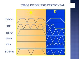DPCA
DPI
DPCC
DPNI
DPT
PD Plus
TIPOS DE DIÁLISIS PERITONEAL
 