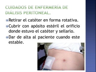 Retirar el catéter en forma rotativa.
Cubrir con apósito estéril el orificio
donde estuvo el catéter y sellarlo.
Dar de alta al paciente cuando este
estable.
 