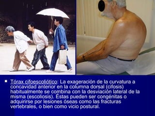  Tórax cifoescoliótico: La exageración de la curvatura a
concavidad anterior en la columna dorsal (cifosis)
habitualmente se combina con la desviación lateral de la
misma (escoliosis). Éstas pueden ser congénitas o
adquirirse por lesiones óseas como las fracturas
vertebrales, o bien como vicio postural.
 
