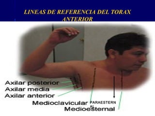 LINEAS DE REFERENCIA DEL TORAX
ANTERIOR
PARAESTERN
AL
 
