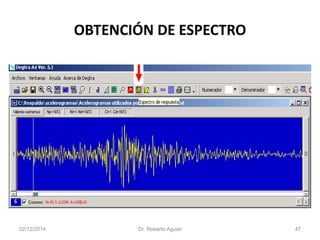 OBTENCIÓN DE ESPECTRO 
02/12/2014 Dr. Roberto Aguiar 47 
 