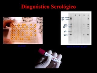 Diagnóstico Serológico




ELISA               WESTERN BLOT
 