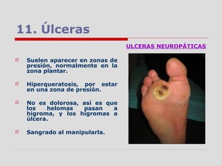 11. Úlceras
ULCERAS NEUROPÁTICAS
 Suelen aparecer en zonas de
presión, normalmente en la
zona plantar.
 Hiperqueratosis, por estar
en una zona de presión.
 No es dolorosa, así es que
los helomas pasan a
higroma, y los higromas a
úlcera.
 Sangrado al manipularla.
 