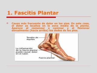 1. Fascitis Plantar
 Causa más frecuente de dolor en los pies. En este caso,
el dolor se localiza en la zona media de la planta.
Aparece al comenzar a caminar y al flexionar
dorsalmente (hacia arriba) los dedos de los pies.
 