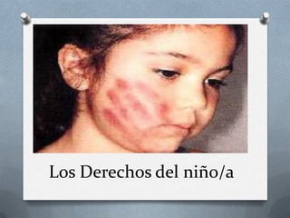 Los Derechos del niño/a
