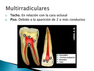 1) Techo. En relación con la cara oclusal
2) Piso. Debido a la aparición de 2 o más conductos