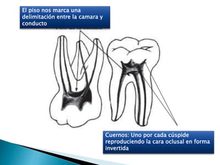 Cuernos: Uno por cada cúspide
reproduciendo la cara oclusal en forma
invertida
El piso nos marca una
delimitación entre la camara y
conducto