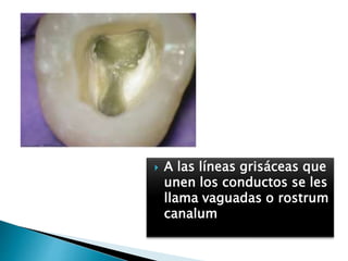  A las líneas grisáceas que
unen los conductos se les
llama vaguadas o rostrum
canalum