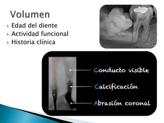  Edad del diente
Actividad funcional
Historia clínica