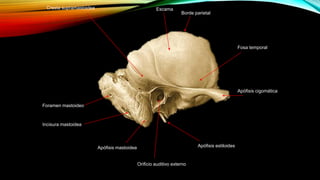 Escama
Borde parietal
Fosa temporal
Apófisis cigomática
Cresta supramastoidea
Incisura mastoidea
Foramen mastoideo
Apófisis mastoidea
Orificio auditivo externo
Apófisis estiloides
 