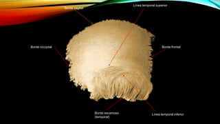 Borde occipital
Borde escamoso
(temporal)
Borde frontal
Borde sagital
Línea temporal superior
Línea temporal inferior
Eminencia parietal
 